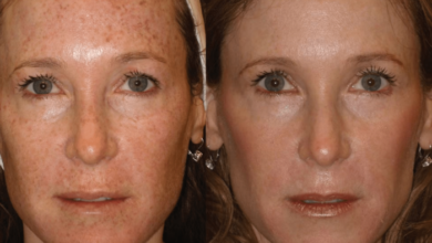 Advanced Light Therapy Guide for Clear, Radiant Skin Results