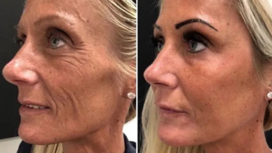 Ultimate Guide to Smoother Skin: Causes, Fixes And Care Tips