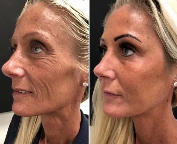 Ultimate Guide to Smoother Skin: Causes, Fixes And Care Tips